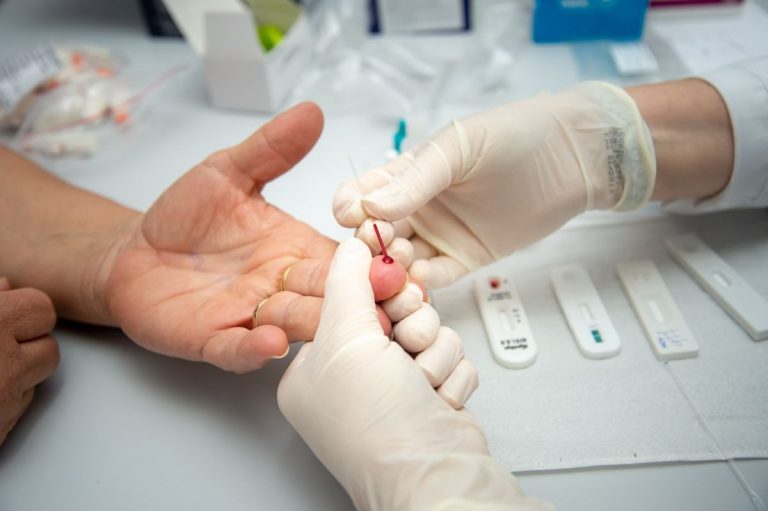 Testes de hepatite são oferecidos de graça nas Unidades Básicas de Saúde de Dourados. Foto: Divulgação/Assecom